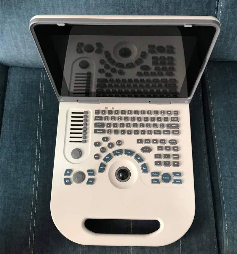 NYRO 10 Notebook Ultrasound Machine Importer Pakistan - Image 4