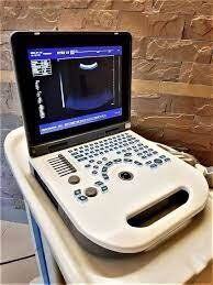 Notebook Ultrasound Machine