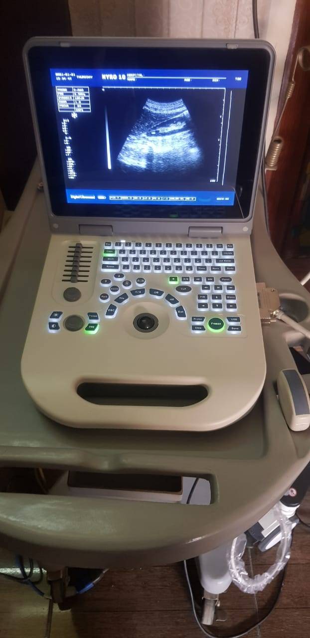 NYRO 10 Notebook Ultrasound Machine Importer Pakistan - Image 6