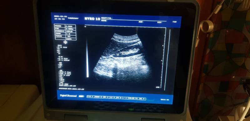 NYRO 10 Notebook Ultrasound Machine Importer Pakistan - Image 7