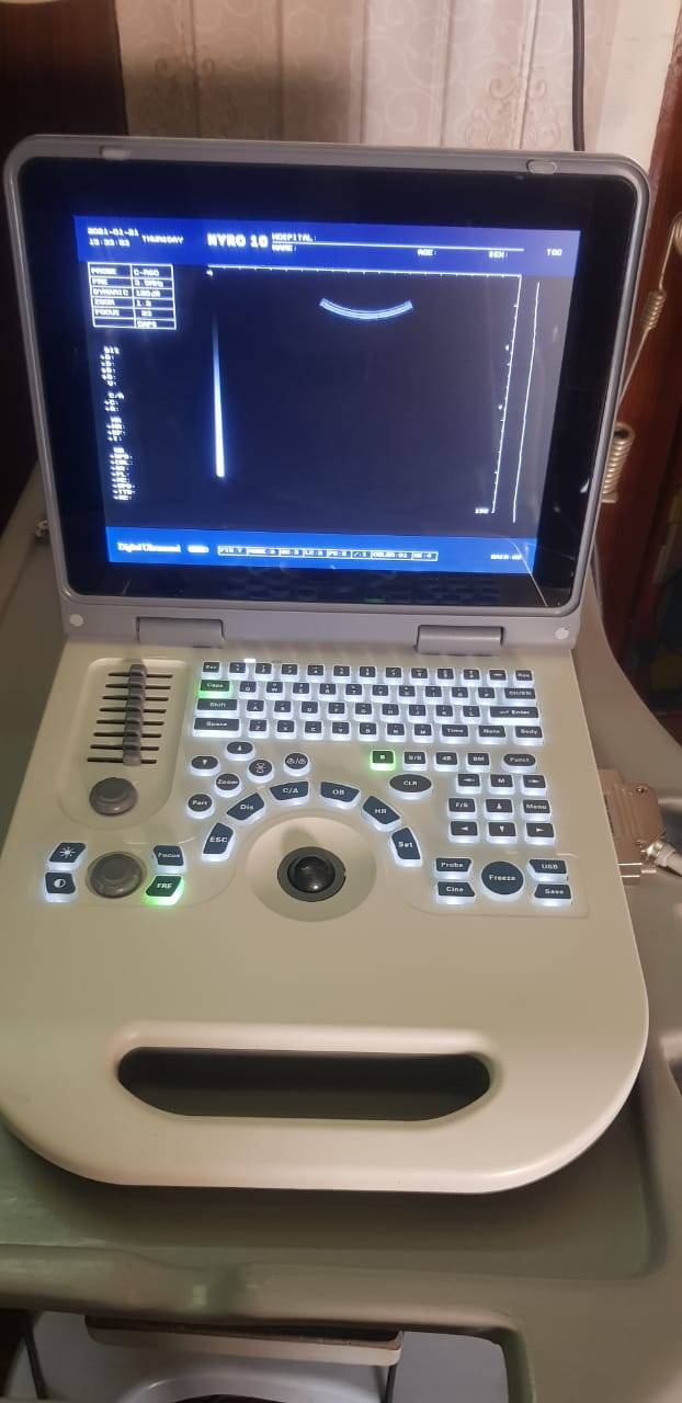 NYRO 10 Notebook Ultrasound Machine Importer Pakistan - Image 8