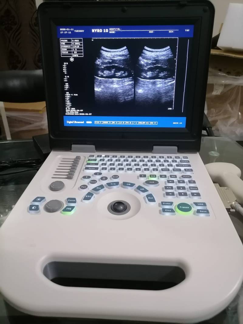 NYRO 10 Notebook Ultrasound Machine Importer Pakistan - Image 10