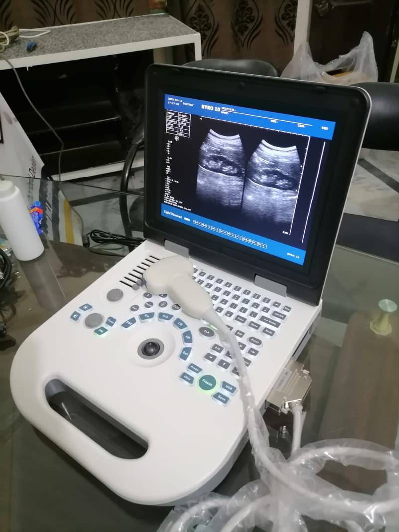 NYRO 10 Notebook Ultrasound Machine Importer Pakistan - Image 11