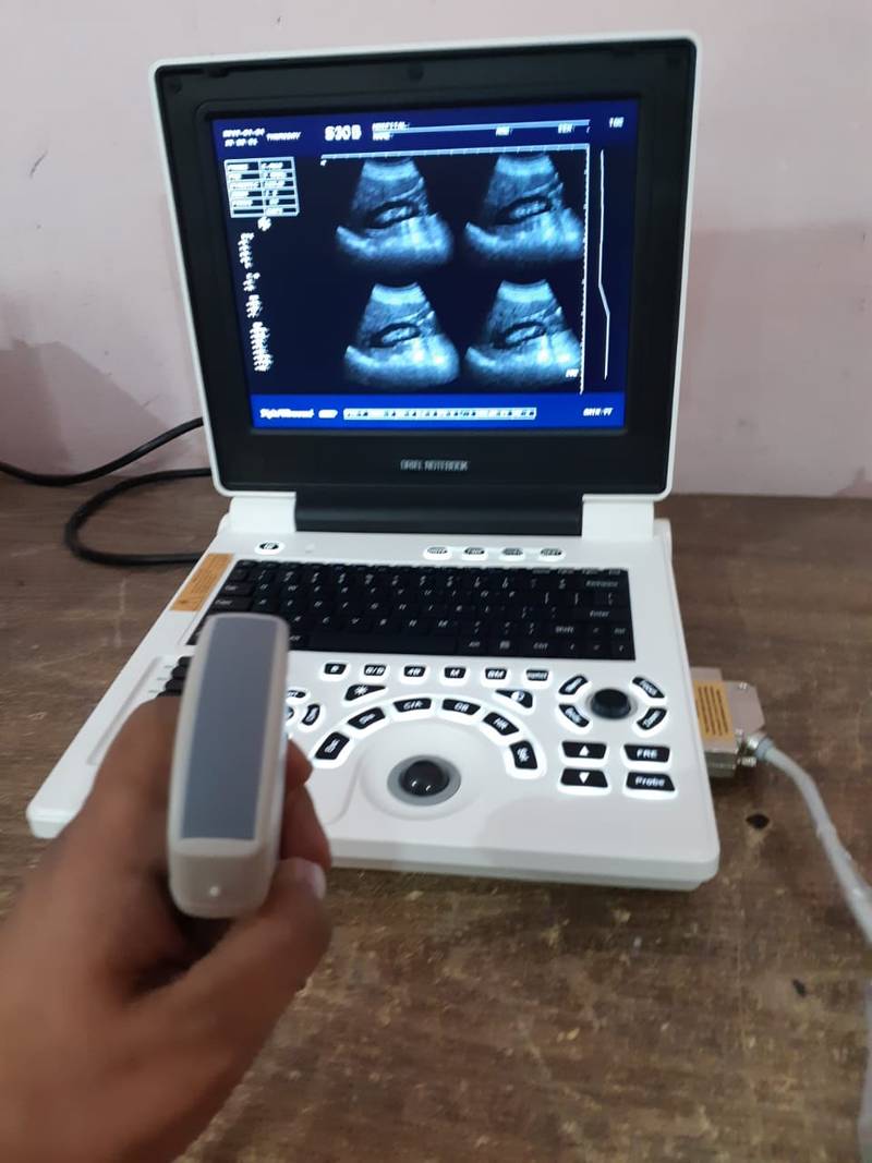 Notebook Portable Ultrasound Machine Importer Pakistan - Image 3