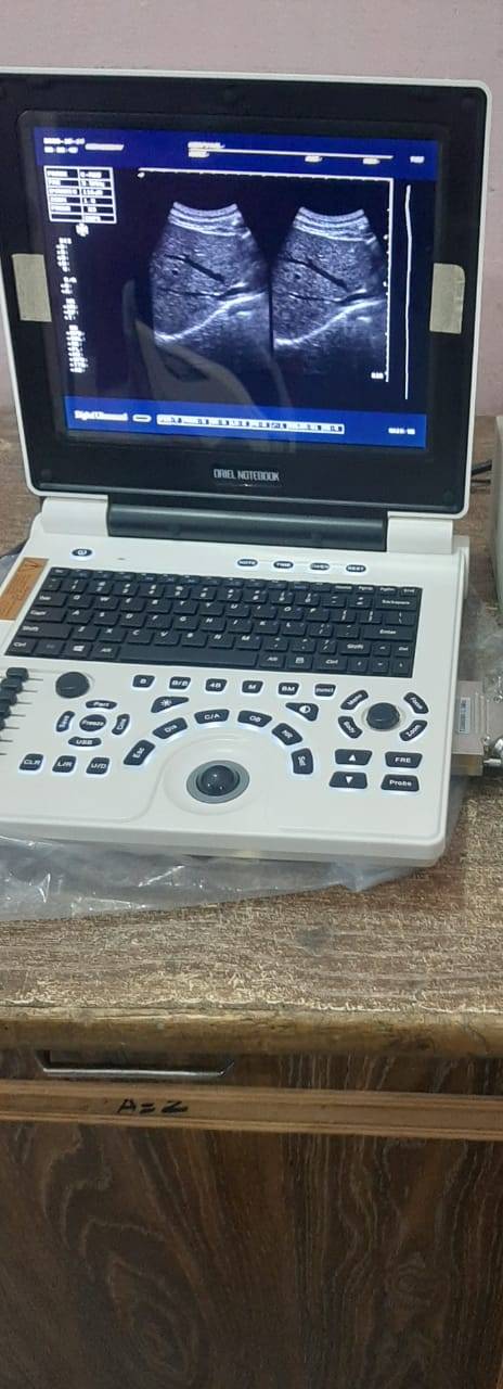 Notebook Portable Ultrasound Machine Importer Pakistan - Image 4