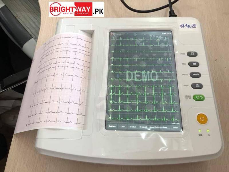 12-Channel Digital Touch ECG Machine for Accurate Diagnosis - Image 2