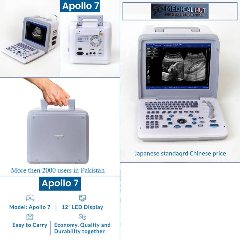 Apollo 7 Portable Ultrasound – Compact, Clear & Reliable