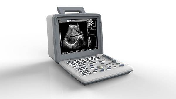 Apollo 7 Portable Ultrasound – Compact, Clear & Reliable - Image 2