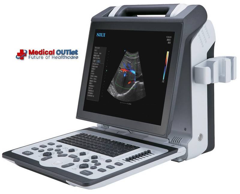 Portable 4D Color Doppler Ultrasound Machine - 4D Color Doppler - SIUI Apogee 2300 Portable Ultrasound